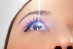 photo about laser eye surgery - 658